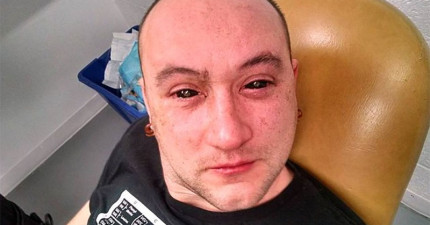 晚上可以看到眼藥水